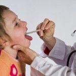 Tonsillite: un disturbo comune nei bambini